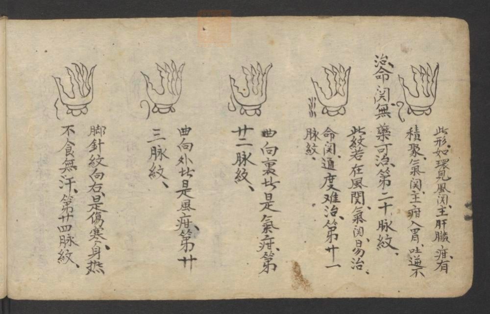 全抄小儿推拿广意(第22页)