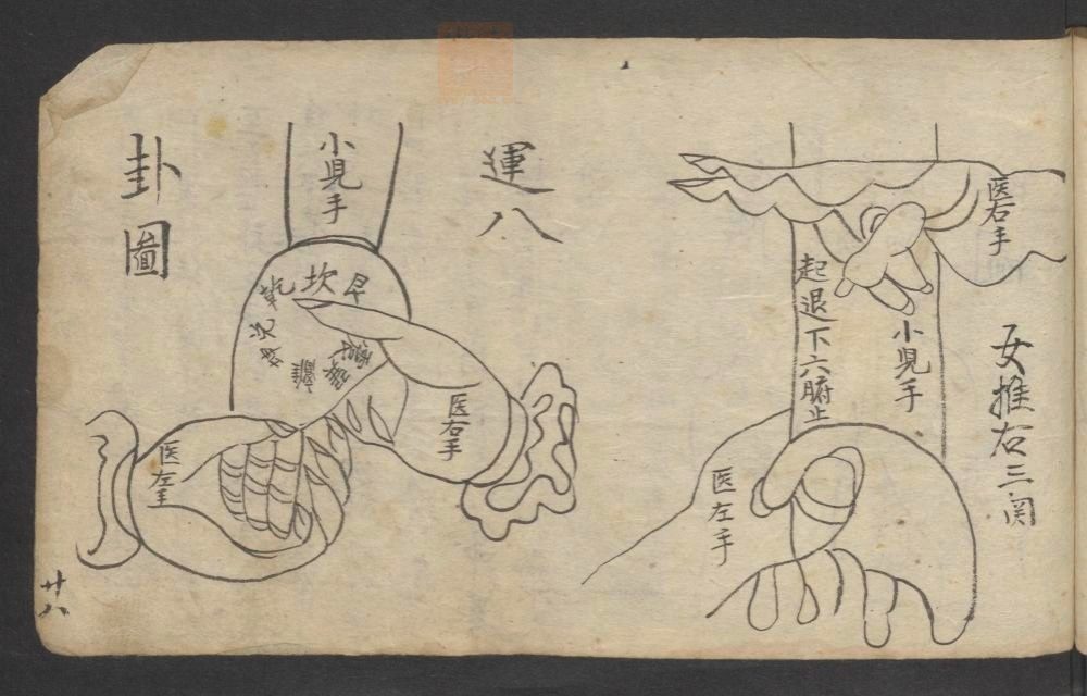 全抄小儿推拿广意(第47页)