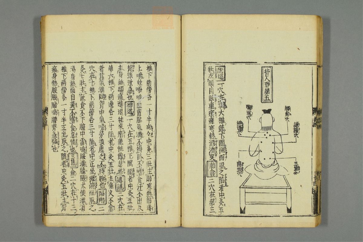 新刊黄帝明堂灸经(第36页)