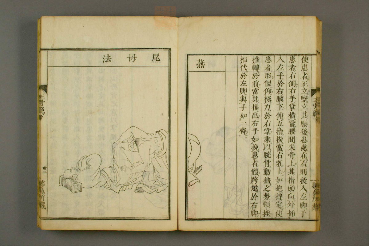 正骨范(第83页)