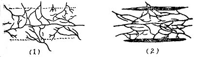 皮管形成术